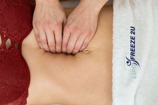 diastasis recti treatment Oxfordshire