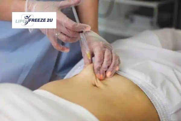 Fat Dissolving Injections Oxfordshire & Weight loss medication