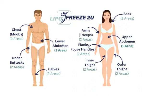 Areas you can have fat freezing treatment Oxfordshire