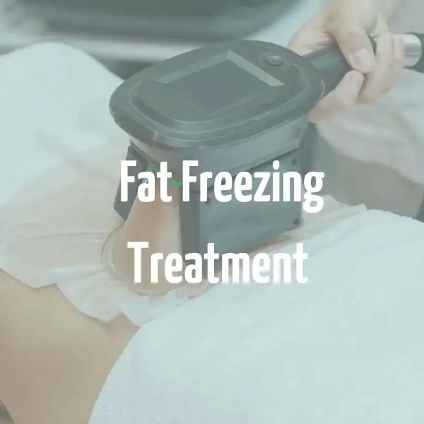 fat freezing treatment Oxfordshire