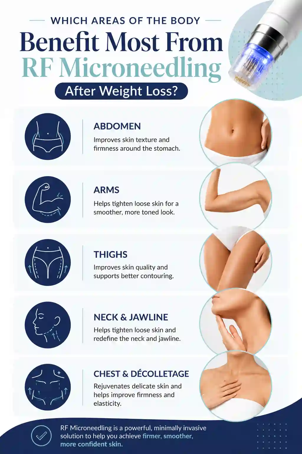 Which Areas of the Body Benefit Most From RF Microneedling After Weight Loss Oxfordshire